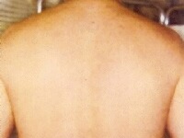 depilace8