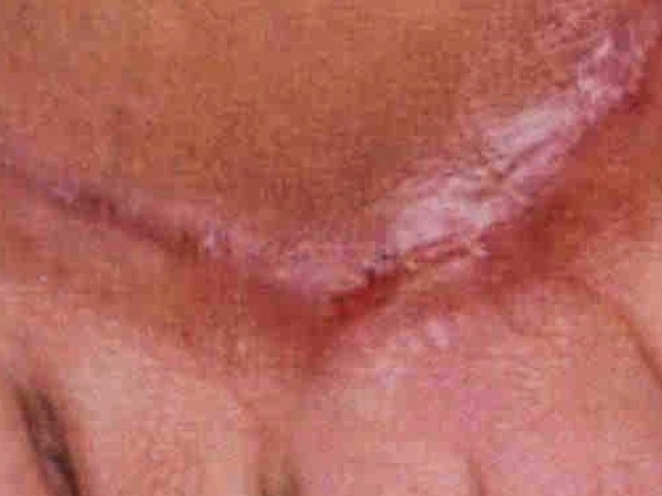ematrix1