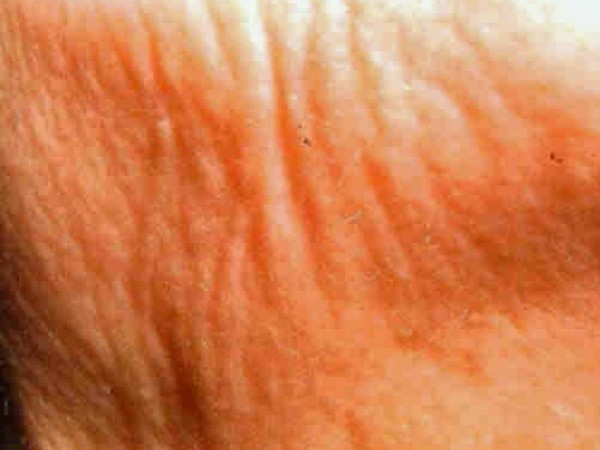 ematrix5