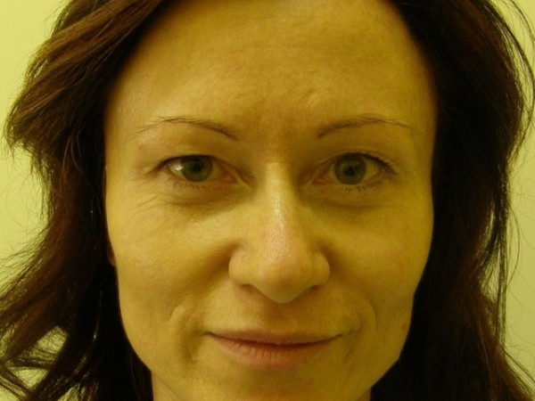 plastikavicek3